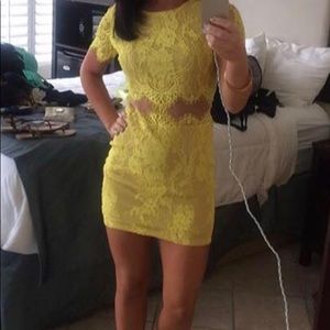 Yellow Lace Dress